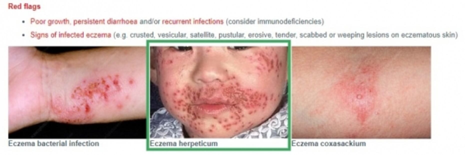 ¿Cubrebocas contra el Covid pueden causar enfermedades en la piel? 