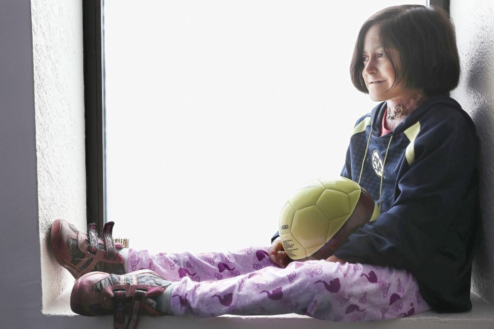 María Pura Porras Gómez sufre epidermolisis bullosa distrófica recesiva, lo que le provoca úlceras y laceraciones en la piel con mínimo roce (JUAN CARLOS REYES. EL UNIVERSAL)