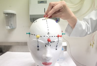 Pretenden hackear el cerebro para curar males