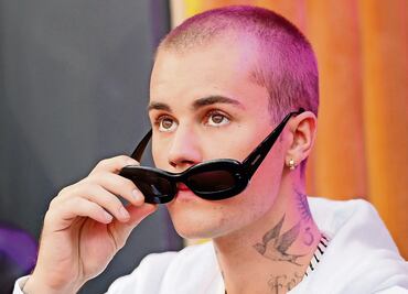 ¿Qué es el síndrome de Ramsay Hunt?, la enfermedad que padece Justin Bieber