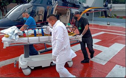 ADVERTENCIA DE IMÁGENES: Golpean y queman a hombre en Xochimilco; lo dejan con un palo de escoba en la garganta