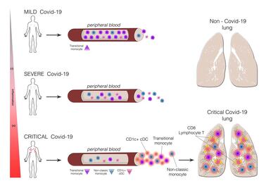 COVID-19 afecta a distintas células del sistema inmunitario según la gravedad