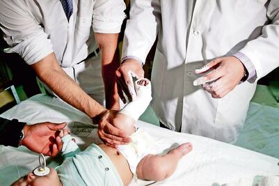 IMSS usa técnica de yesos para curar bebés 