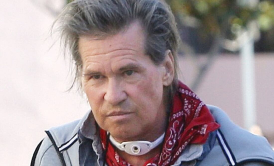 Salud. Kilmer acudió a una tienda de Malibú con el aparato colocado. Desde principios de año ha entrado y salido del hospital (TOMADO DEL DAILY MAIL)