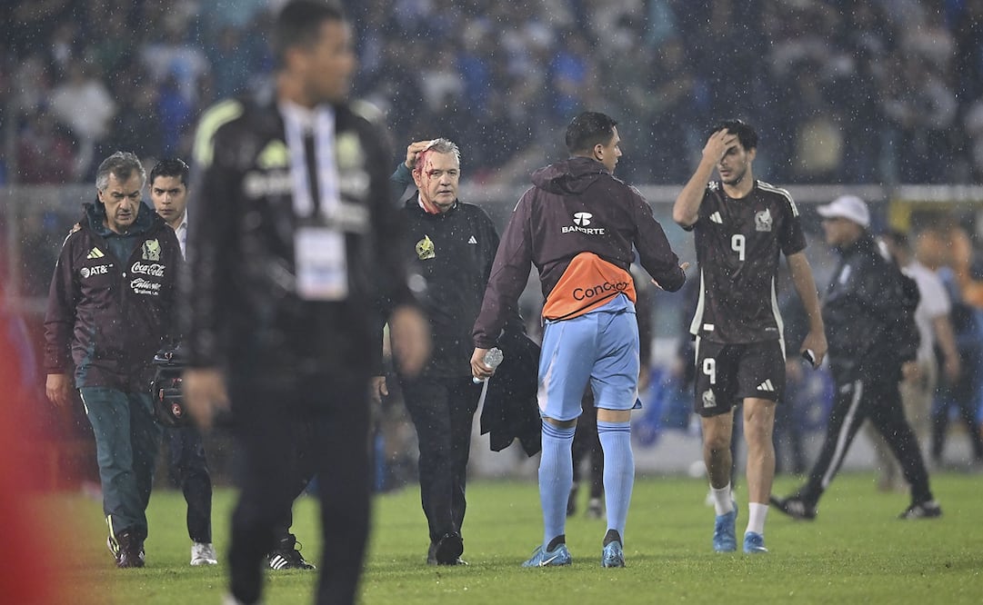 Javier Aguirre con el rostro ensangrentado, tras el partido entre México y Honduras de la Nations League -Foto: Imago7