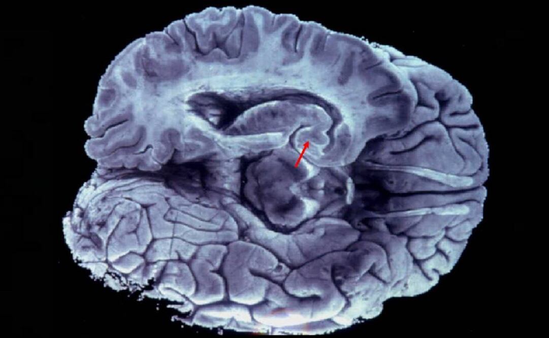 Los tumores tratados con esta molécula mostraron un crecimiento inhibido con respecto a los que solo recibieron radioterapia. (FOTO: Archivo EL UNIVERSAL) 