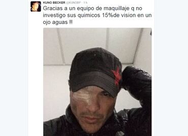 Kuno Becker aún no recupera visión en ojo