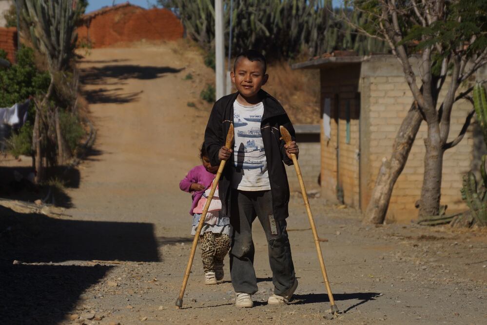 Eduardo es un niño que vive en el municipio más pobre del país y se enfrenta a la discapacidad motriz. Foto: Edwin Hernández / EL UNIVERSAL