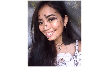 La modelo con lunares y verrugas que rompe esquemas