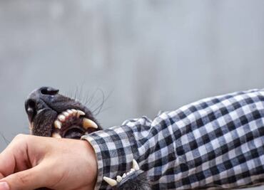 Perro pastor australiano muerde a niña de año y medio en Yucatán