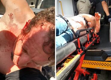 Hombre enfrenta a dos presuntos ladrones; hiere a uno