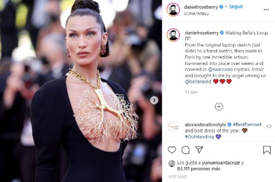 Pezoneras doradas, la atrevida tendencia entre las famosas