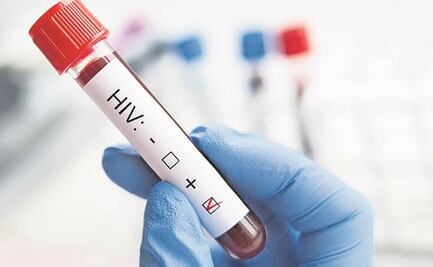 Aumenta tasa de nuevos casos de infección por VIH en Yucatán 