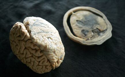 Tu cerebro cambia si apoyas a un partido político: estudio