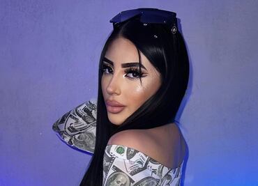 Bellakath revela que estuvo a punto de morir por cirugías estéticas: "fue algo complicado"