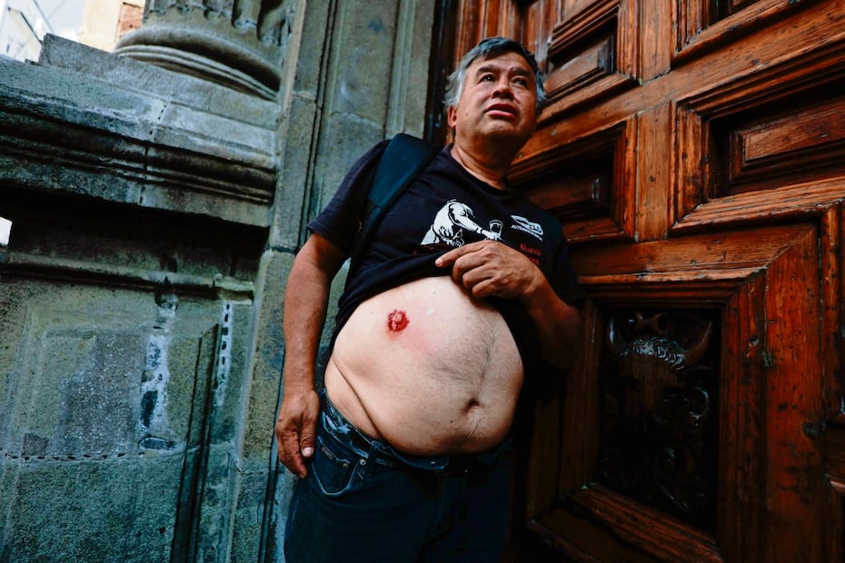 Un transeúnte resultó herido en el abdomen durante la refriega.Foto: Diego Simón / EL UNIVERSAL