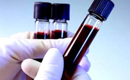 Desarrollan el vaso sanguíneo artificial más fino