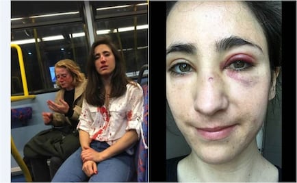 "No quisieron besarse", mujeres terminan heridas en ataque homofóbico en Londres