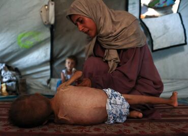 Hambruna en Gaza: “Las personas son cadáveres andantes”, denuncia jefe de la Agencia de la ONU para Refugiados