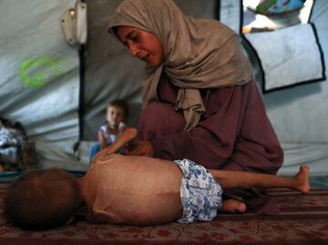 Hambruna en Gaza: “Las personas son cadáveres andantes”, denuncia jefe de la Agencia de la ONU para Refugiados