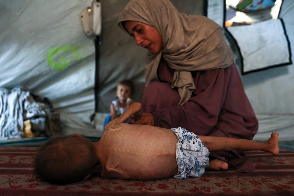 Hidaya, una madre palestiina de 31 años, con su hijo enfermo, Mohammed al-Mutawaq, de 18 meses, en el campo de refugiados Al-Shati, al oeste de Ciudad de Gaza. FOTO: OMAR AL-QATTAA. AFP