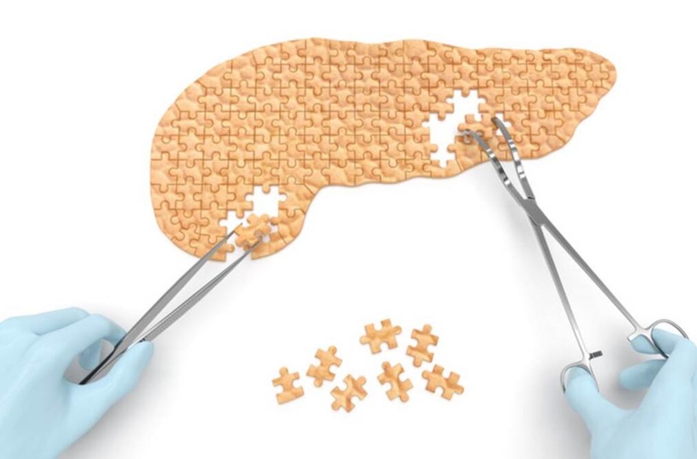 ¿Qué es la Pancreatitis Aguda?
