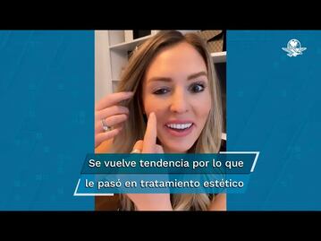 Influencer se inyecta botox en la cara y se le cae el párpado 