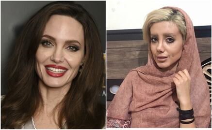 Una joven iraní se realizó 50 operaciones para lucir como Angelina Jolie y el resultado es impactante
