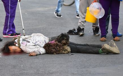 Camión atropella a un hombre en Iztapalapa; mascota vigila el cadáver