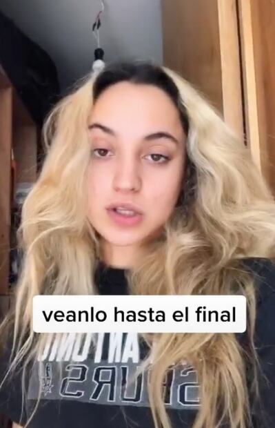 Mujer se pinta el pelo y le causa alergia: mira lo que pasó