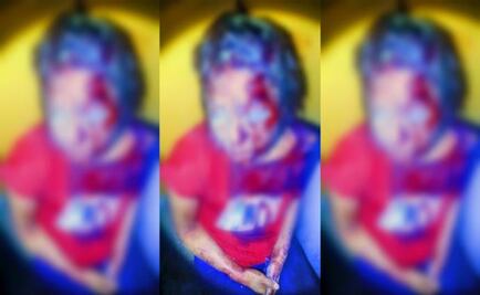 Niña pide ayuda porque su padre golpeaba a su madre en la Peralvillo