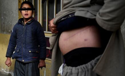 “Vendí mi riñón para que mis hijos coman”: el drama de decenas de afganos