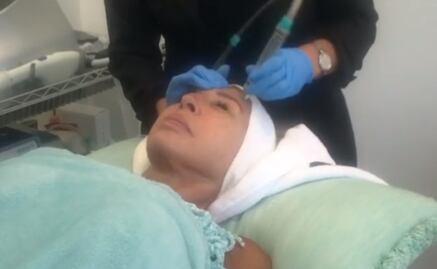 Laura Bozzo “rejuvenece” en Instagram con tratamiento estético