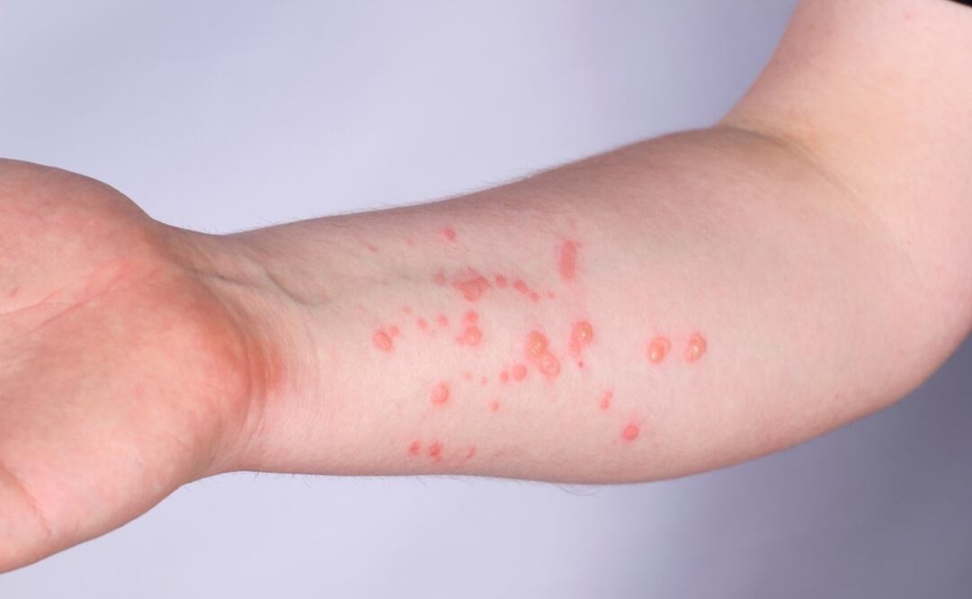 Foto: Archivo/ EL UNIVERSAL 