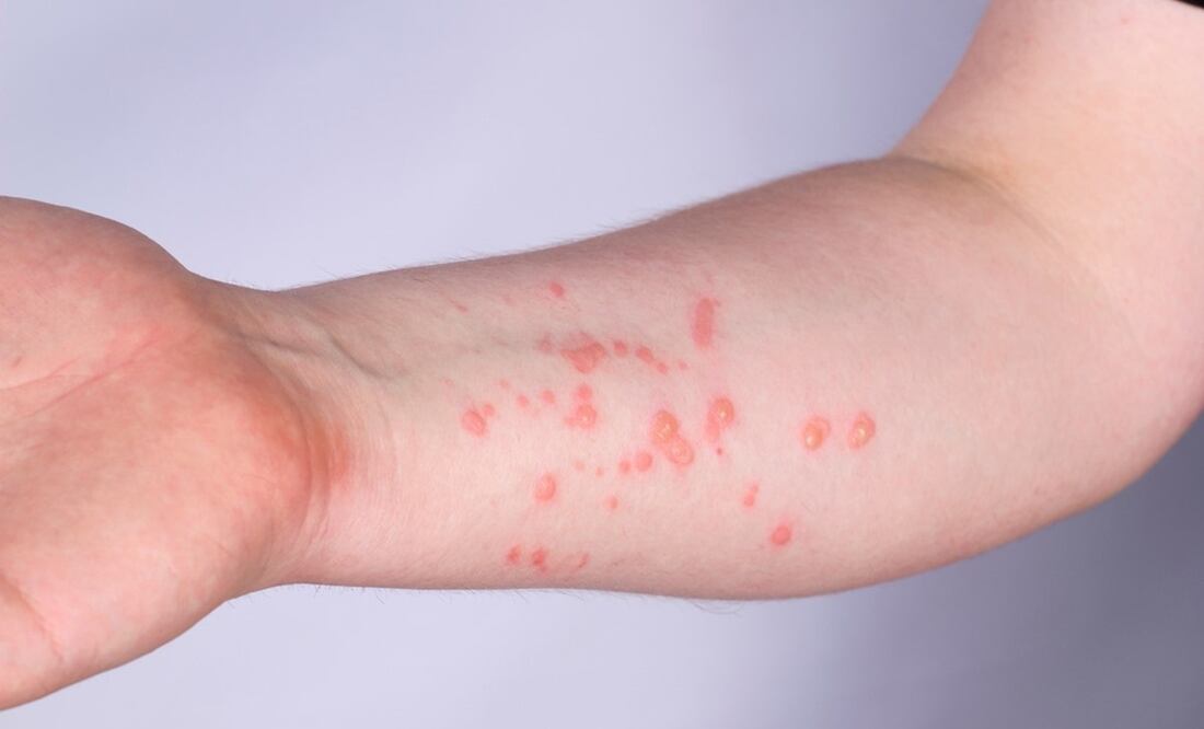 Foto: Archivo/ EL UNIVERSAL