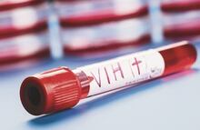 Estados Unidos aprueba nuevo tratamiento preventivo contra el VIH; "es un día histórico", destaca laboratorio