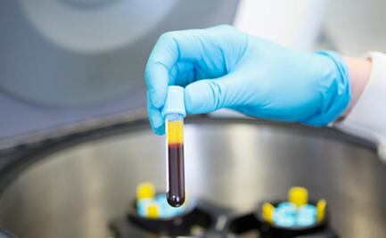 Toshiba crea sistema para detectar cáncer