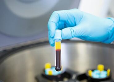 Toshiba crea sistema para detectar cáncer