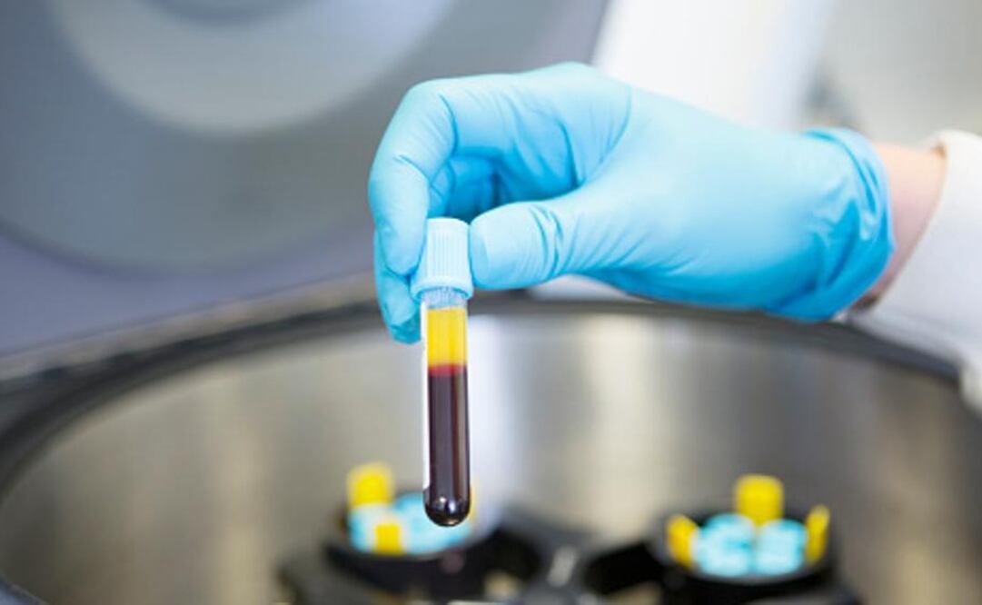 Esta herramienta de detección analiza las micromoléculas de ácido ribonucleico (o micro-ARN) de esa gota de sangre para una identificación temprana de enfermos de cáncer