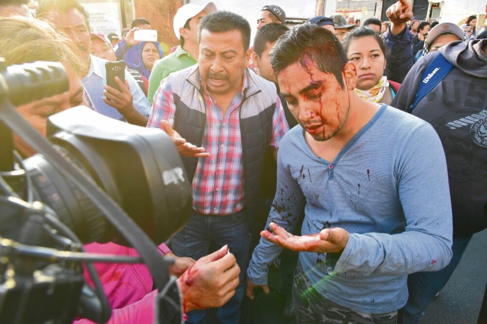 Encontronazo. En la Ciudad de México, integrantes de la CNTE se enfrentaron a golpes con la policía, resultando varios profesores con heridas en la cabeza. (HUGO GARCÍA. EL UNIVERSAL)