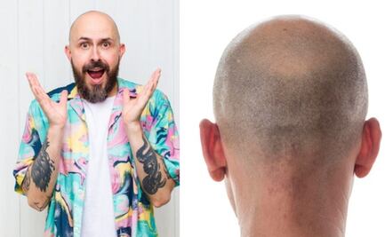 Esta es la mejor forma de gestionar tus emociones al quedarte calvo, según la psicología