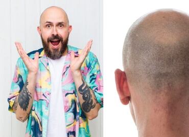 Esta es la mejor forma de gestionar tus emociones al quedarte calvo, según la psicología