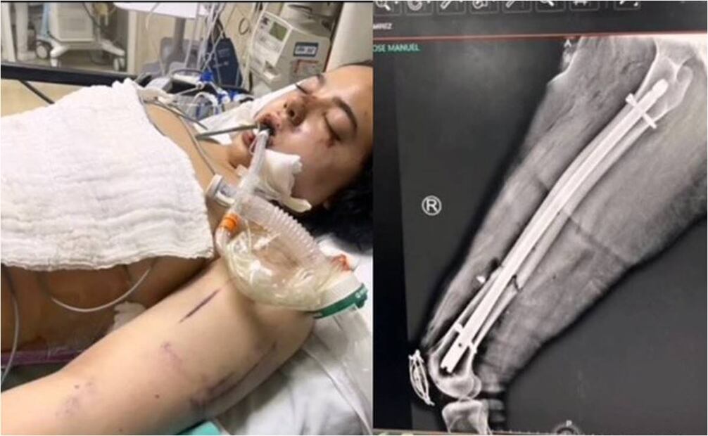 Leonor Uribe víctima de Carlos Gerardo "N" Foto: Especial