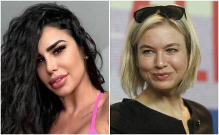 Los rostros de Lis Vega, Reneé Zellweger y Nicole Kidman quedaron ¡irreconocibles!