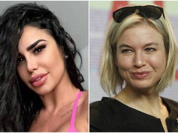 Los rostros de Lis Vega, Reneé Zellweger y Nicole Kidman quedaron ¡irreconocibles!