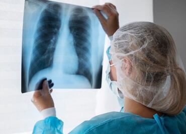 Estos son los beneficios de consumir Omega-3 para los pulmones