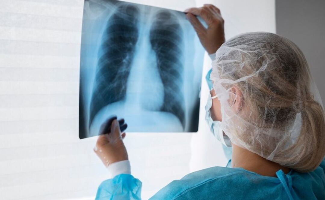 Los beneficios de consumir Omega 3 para la salud. Fuente: Freepik.