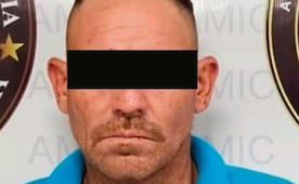 Vinculan a proceso a hombre por presuntamente amputar nariz y labio a joven en Sonora; víctima fue atacada con machete