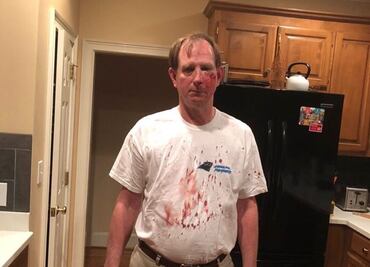 Brutal agresión de fan de los Panthers; NFL investiga