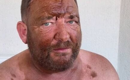 Hombre arruina su cita debido a un percance que tuvo en la playa